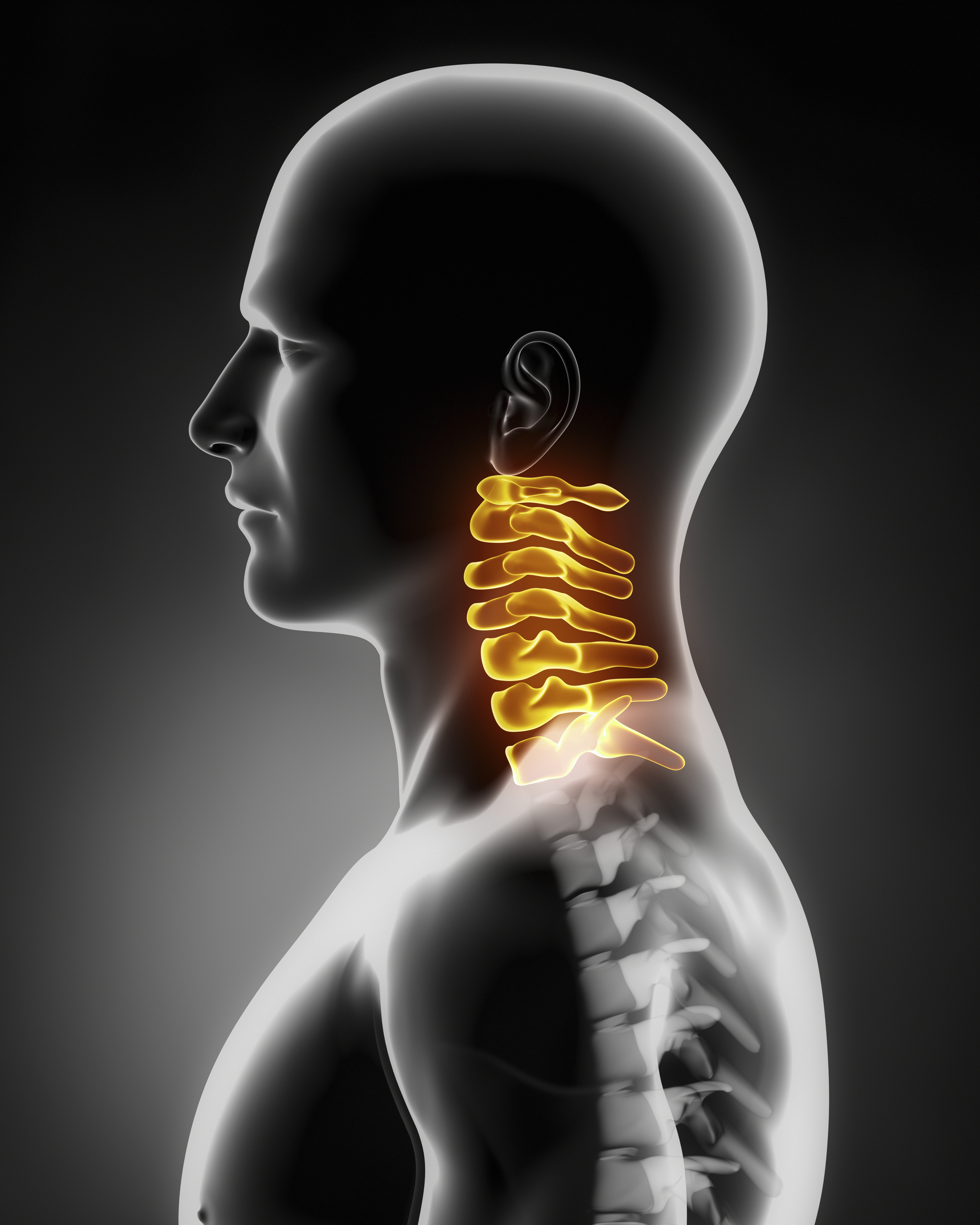 cervical spine surgery neck surgery nyc manhattan new york