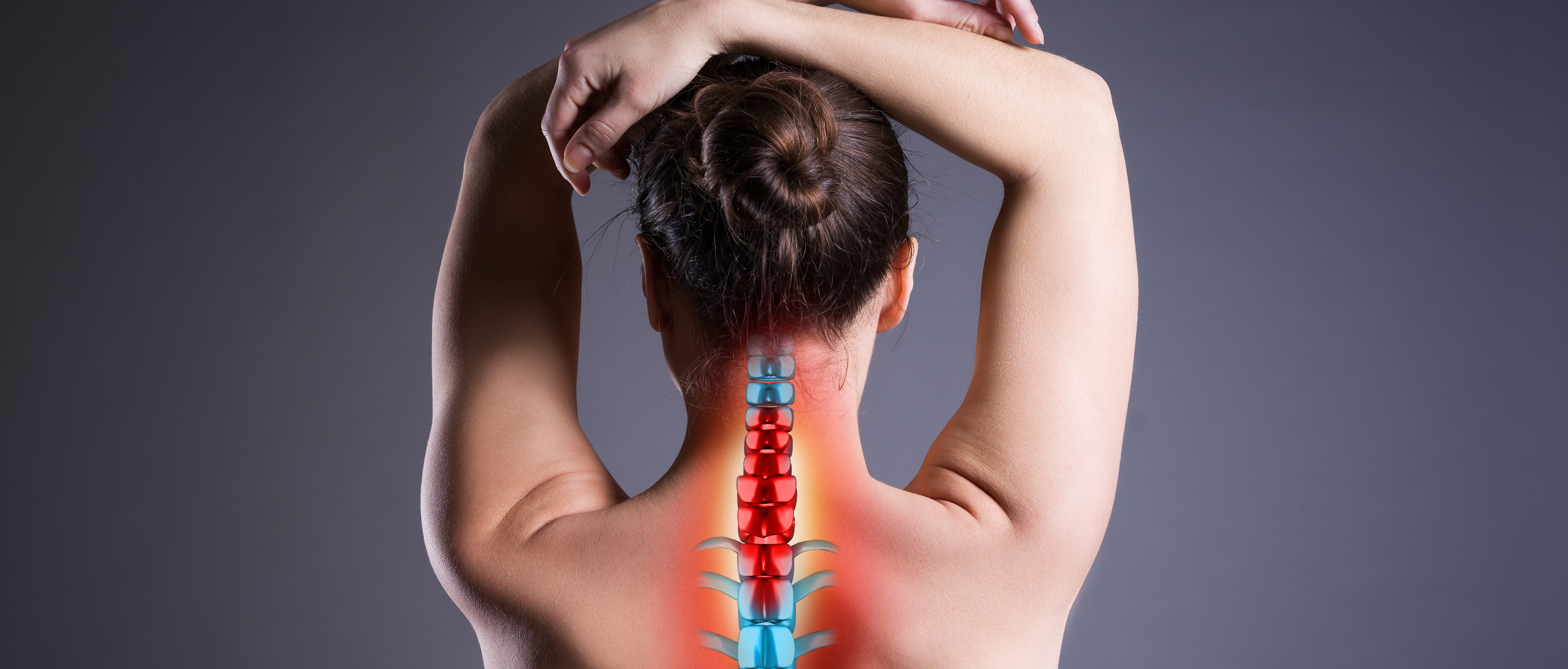 A medical concept image of a womans upper back with her spine highlighted, the woman spine is showing signs of a herniated cervical disc and is illustrated by highlighting the area where its located.