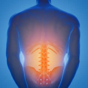 3d-rendered illustration of x-ray male patient’s spine, lower half highlighted orange to represent pain from spinal stenosis