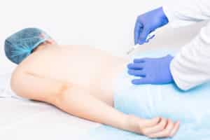 Doctor neurosurgeon holds a scalpel in the background of the patients back