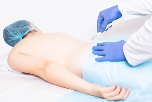 Doctor neurosurgeon holds a scalpel in the background of the patients back