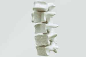 Model of a spinal cord that requires treatment