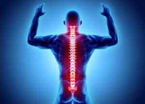 Computer illustration of man's spinal cord - surgery may be necessary to prevent nerve damage